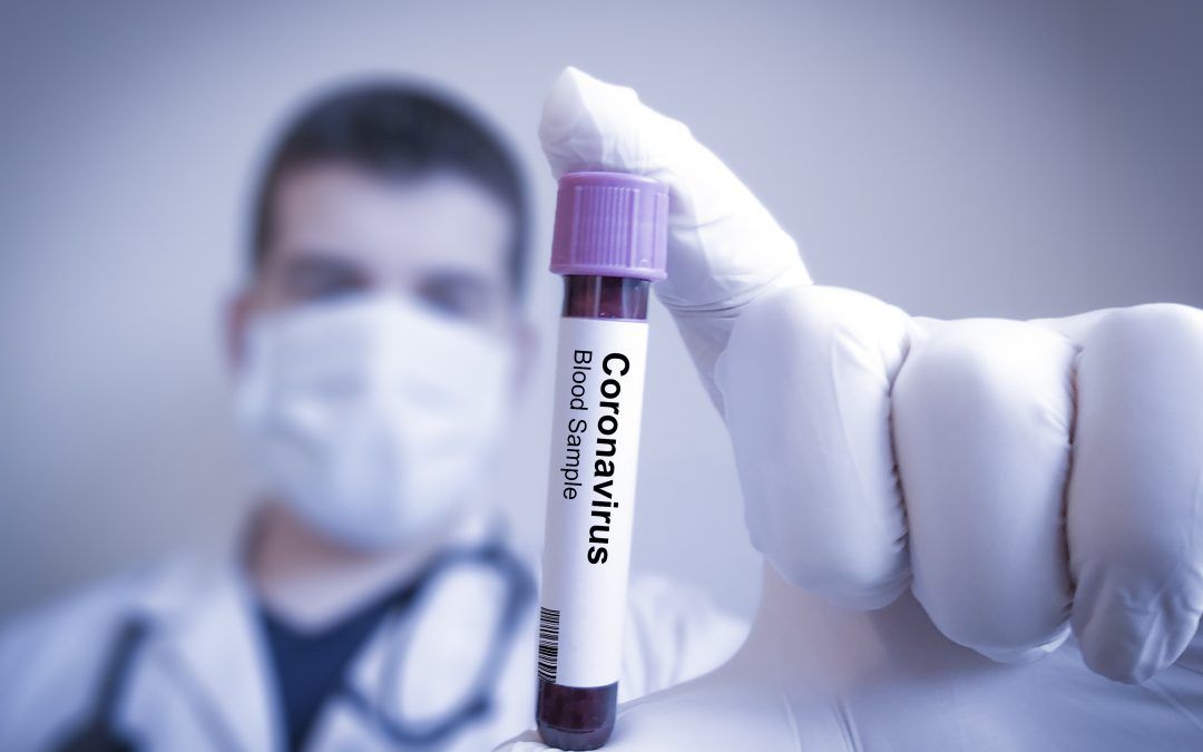 Decálogo sobre el coronavirus en tiempos de Pandemia